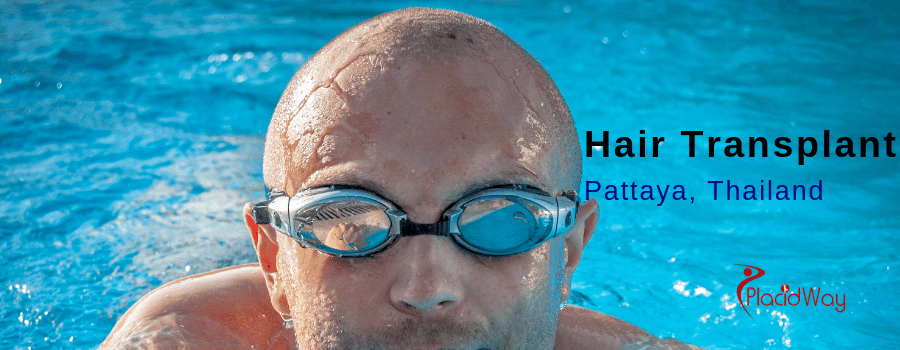 hair transplant in pattaya, thailand